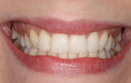 Smile Gallery - Church Road Dental and Cosmetic