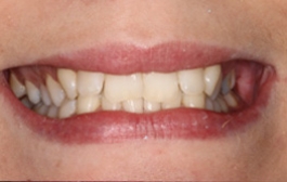 Smile Gallery - Church Road Dental and Cosmetic