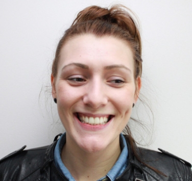 Smile Gallery - Church Road Dental and Cosmetic