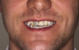 Smile Gallery - Church Road Dental and Cosmetic
