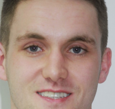 Smile Gallery - Church Road Dental and Cosmetic