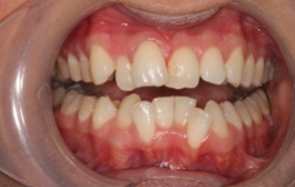 Smile Gallery - Church Road Dental and Cosmetic