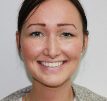 Smile Gallery - Church Road Dental and Cosmetic