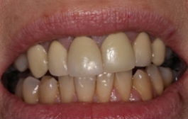 Smile Gallery - Church Road Dental and Cosmetic