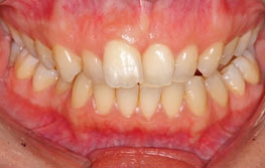 Smile Gallery - Church Road Dental and Cosmetic