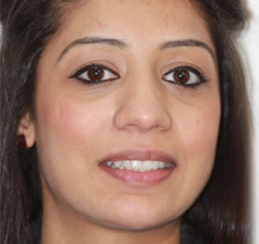 Smile Gallery - Church Road Dental and Cosmetic