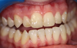 Smile Gallery - Church Road Dental and Cosmetic