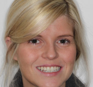 Smile Gallery - Church Road Dental and Cosmetic