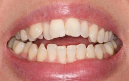 Smile Gallery - Church Road Dental and Cosmetic