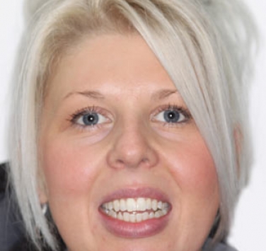 Smile Gallery - Church Road Dental and Cosmetic