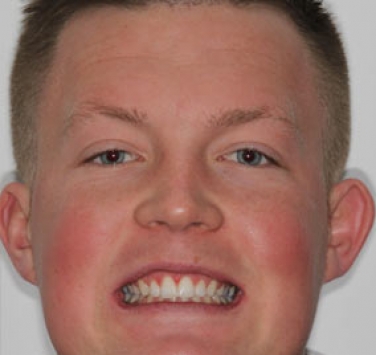 Smile Gallery - Church Road Dental and Cosmetic