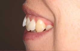 Smile Gallery - Church Road Dental and Cosmetic