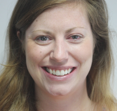 Smile Gallery - Church Road Dental and Cosmetic