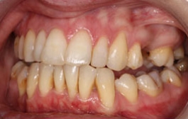 Smile Gallery - Church Road Dental and Cosmetic
