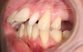 Smile Gallery - Church Road Dental and Cosmetic