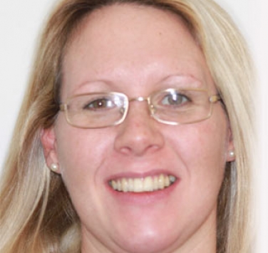 Smile Gallery - Church Road Dental and Cosmetic