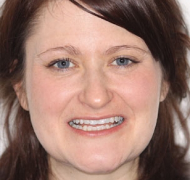 Smile Gallery - Church Road Dental and Cosmetic