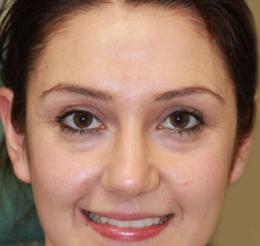 Smile Gallery - Church Road Dental and Cosmetic