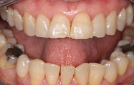 Smile Gallery - Church Road Dental and Cosmetic