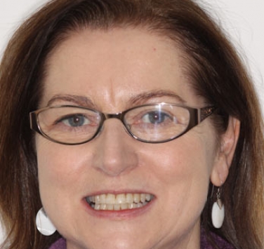 Smile Gallery - Church Road Dental and Cosmetic
