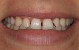 Smile Gallery - Church Road Dental and Cosmetic