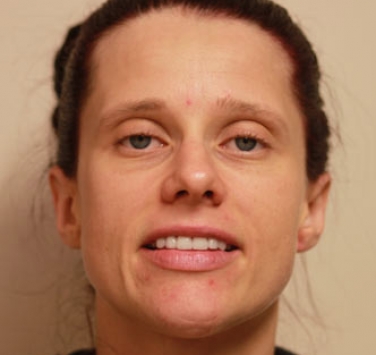 Smile Gallery - Church Road Dental and Cosmetic