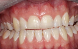 Smile Gallery - Church Road Dental and Cosmetic