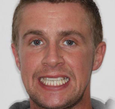 Smile Gallery - Church Road Dental and Cosmetic