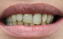 Smile Gallery - Church Road Dental and Cosmetic