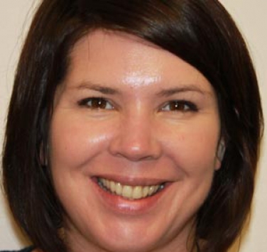 Smile Gallery - Church Road Dental and Cosmetic