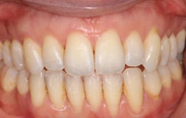 Smile Gallery - Church Road Dental and Cosmetic