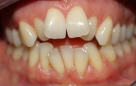 Smile Gallery - Church Road Dental and Cosmetic