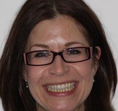 Smile Gallery - Church Road Dental and Cosmetic