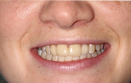 Smile Gallery - Church Road Dental and Cosmetic