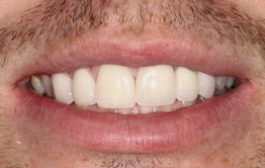 Smile Gallery - Church Road Dental and Cosmetic