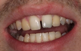 Smile Gallery - Church Road Dental and Cosmetic