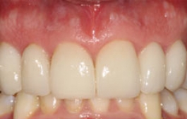 Smile Gallery - Church Road Dental and Cosmetic