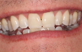 Smile Gallery - Church Road Dental and Cosmetic