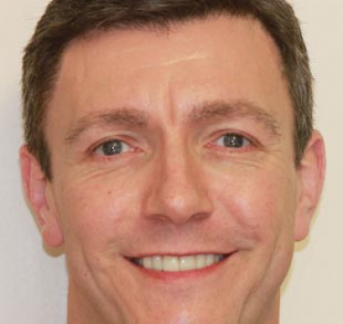 Smile Gallery - Church Road Dental and Cosmetic