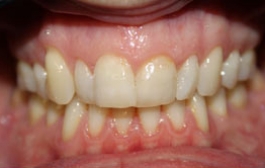 Smile Gallery - Church Road Dental and Cosmetic