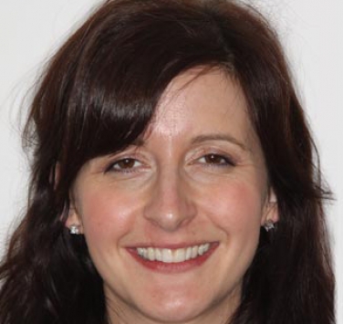 Smile Gallery - Church Road Dental and Cosmetic