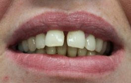 Smile Gallery - Church Road Dental and Cosmetic