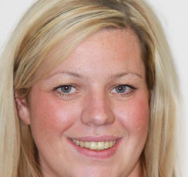 Smile Gallery - Church Road Dental and Cosmetic
