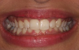 Smile Gallery - Church Road Dental and Cosmetic