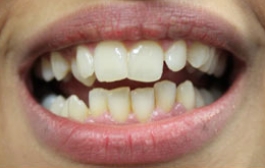 Smile Gallery - Church Road Dental and Cosmetic