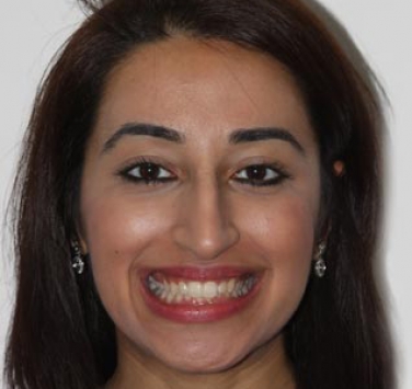 Smile Gallery - Church Road Dental and Cosmetic