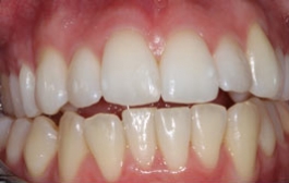 Smile Gallery - Church Road Dental and Cosmetic