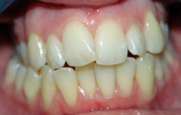 Smile Gallery - Church Road Dental and Cosmetic