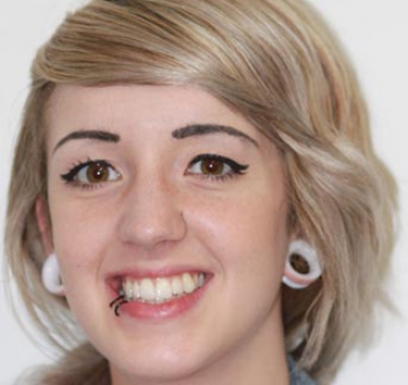 Smile Gallery - Church Road Dental and Cosmetic