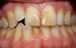 Smile Gallery - Church Road Dental and Cosmetic